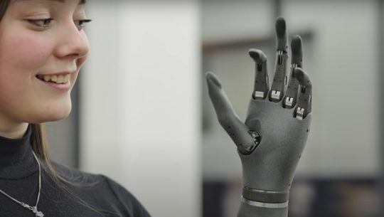 This Bionic Hand Actually Improves Function Over Time
